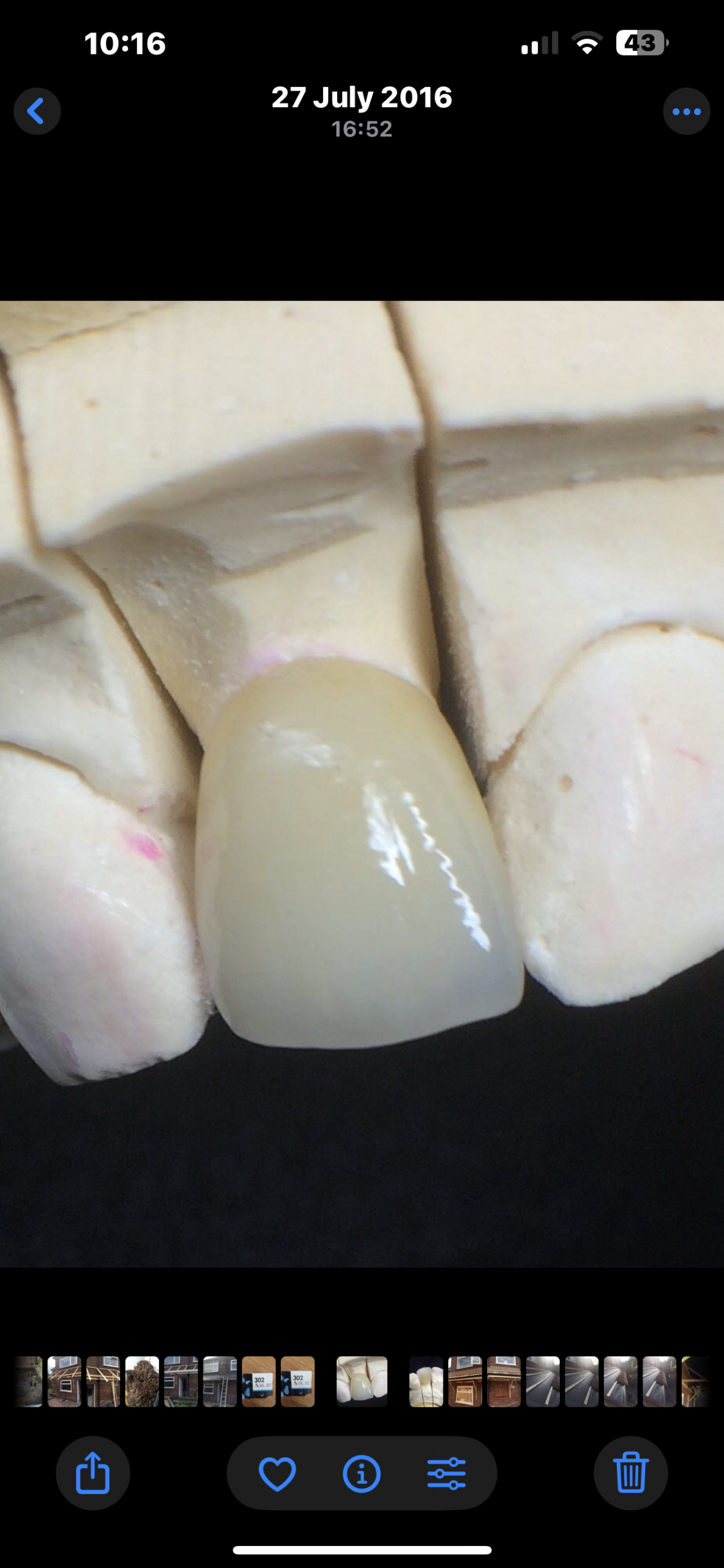 E max Oldham tooth clinic