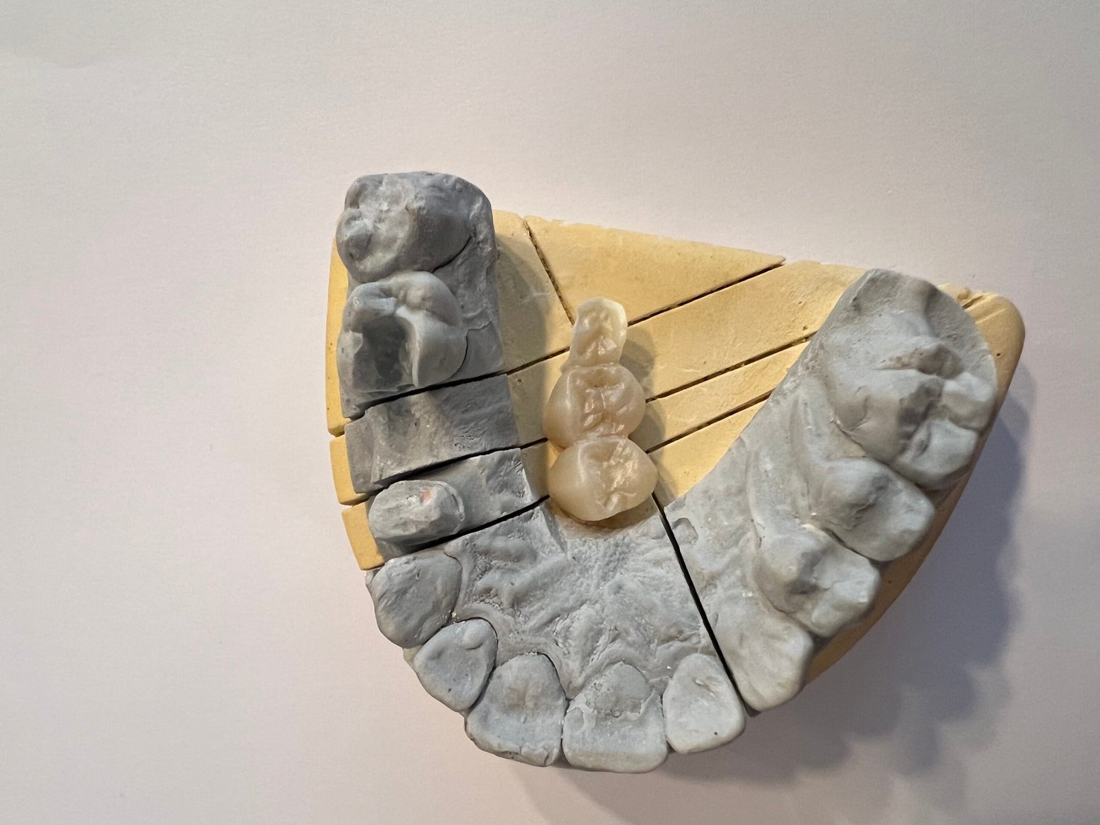 Zirconia mold oldham