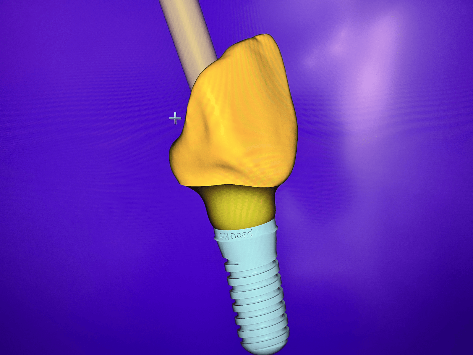 Denture repair Oldham