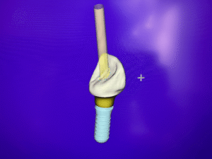 Denture repair Oldham